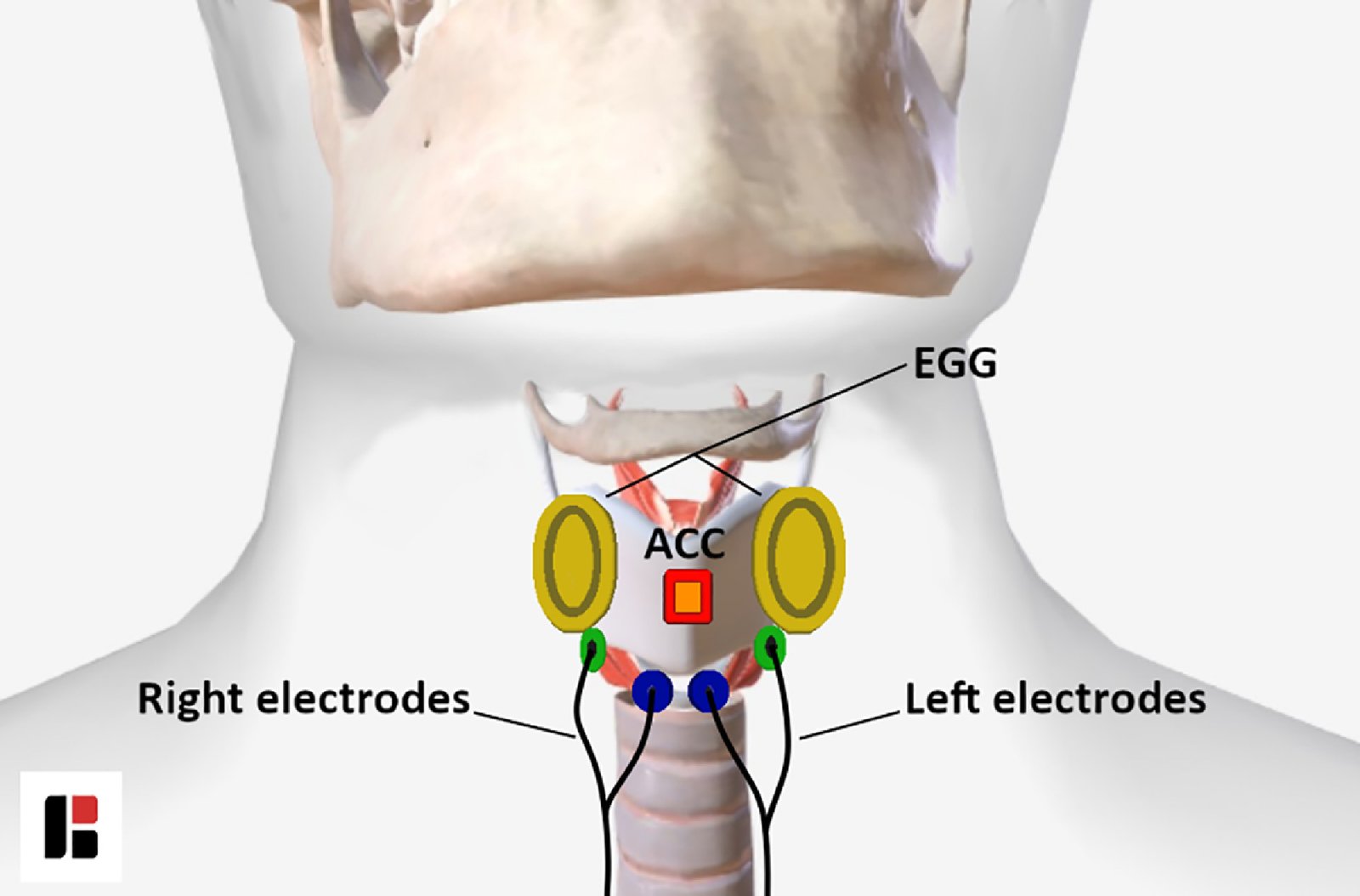 ElectricalLaryngealStimulation