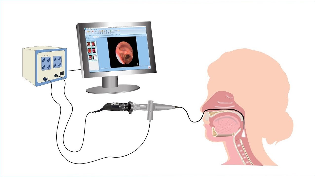 Stroboscopy